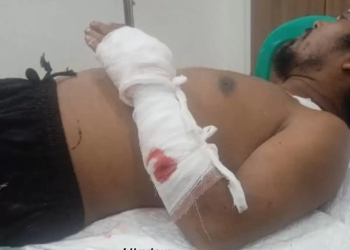 Lagi Nonton TV Bersama Ayah, Warga Bangka Barat Diserang Tetangga Pakai Golok hingga Luka Parah